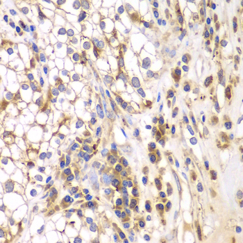 Anti-SRPK1 Antibody (CAB5854)