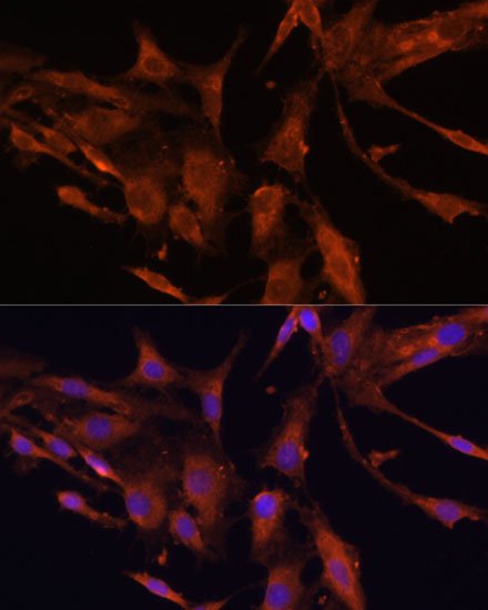 Anti-RECK Antibody (CAB6718)