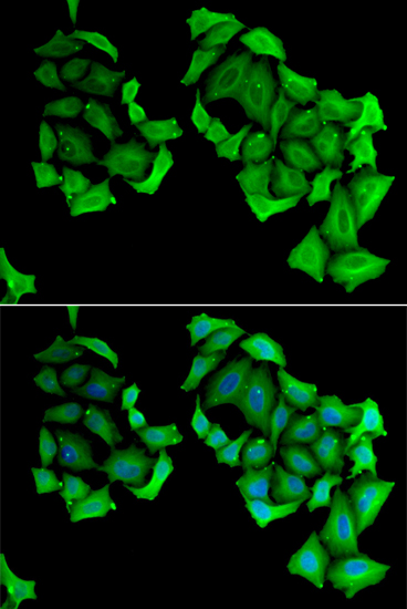 Anti-C4BPB Antibody (CAB6362)