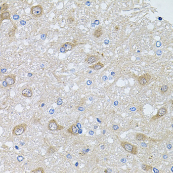 Anti-AKAP5 Antibody (CAB6520)