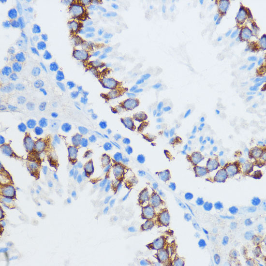 Anti-IGF2BP3 Antibody (CAB6099)