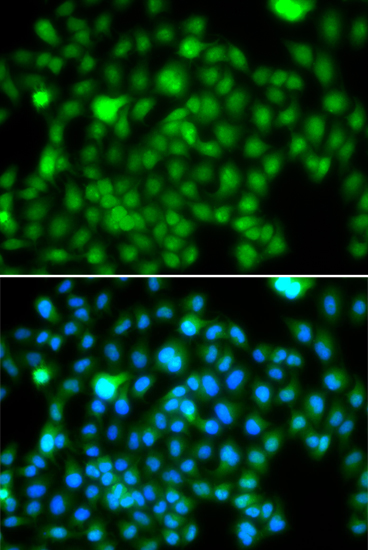 Anti-N6AMT1 Antibody (CAB7201)