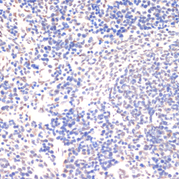 Anti-Phospho-Jak2-Y1007/1008 Antibody (CABP0531)