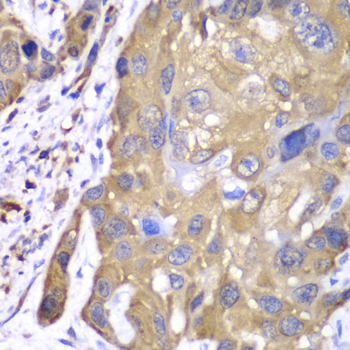 Anti-PRDX1 Antibody (CAB1842)