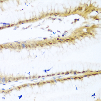 Anti-UNG Antibody (CAB1261)