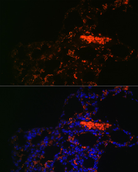 Anti-ABCG1 Antibody (CAB4328)