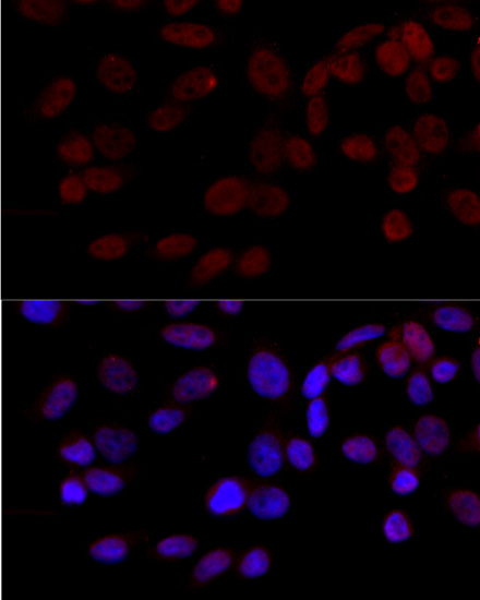 Anti-JNK1 Antibody (CAB0288)