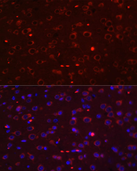 Anti-STAT3 Antibody [KO Validated] (CAB1192)