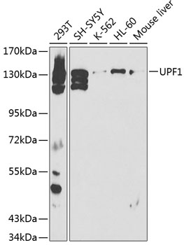 Anti-UPF1 Antibody (CAB1521)