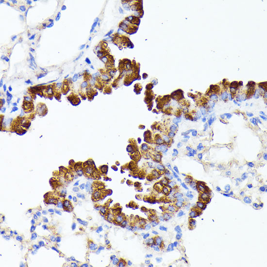 Anti-SMYD4 Antibody (CAB7310)