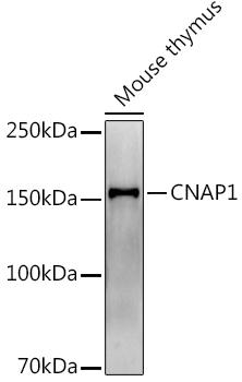 Western blot analysis of extracts of Mouse thymus, using at 1:1000 dilution. Secondary antibody: HRP Goat Anti-Rabbit IgG (H+L) at 1:10000 dilution. Lysates/proteins: 25ug per lane. Blocking buffer: 3% nonfat dry milk in TBST. Detection: ECL Enhanced Kit. Exposure time: 180s.