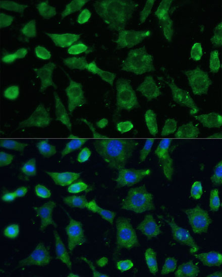 Anti-SPARC Antibody (CAB14494)