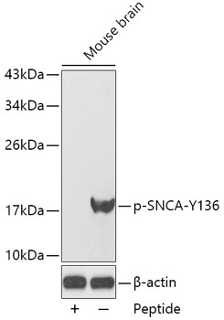 Anti-Phospho-Alpha-synuclein-Y136 Antibody (CABP0254)