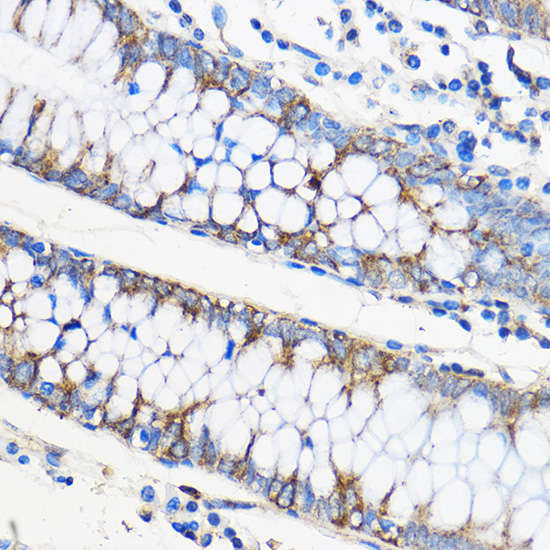 Anti-APOM Antibody (CAB5336)