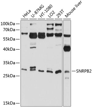 Anti-SNRPB2 Polyclonal Antibody (CAB8908)