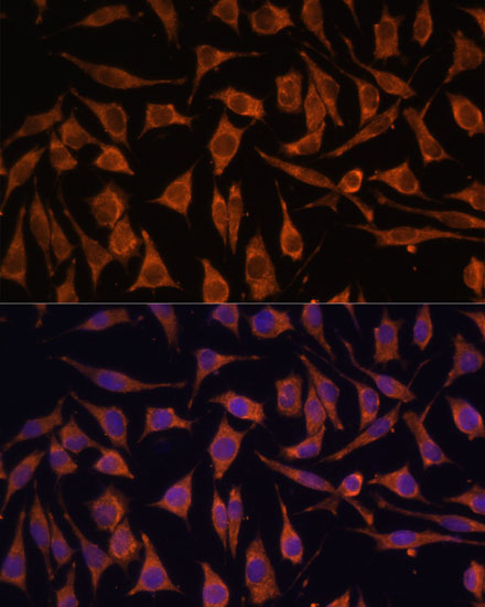 Anti-NDUFA4L2 Antibody (CAB14288)