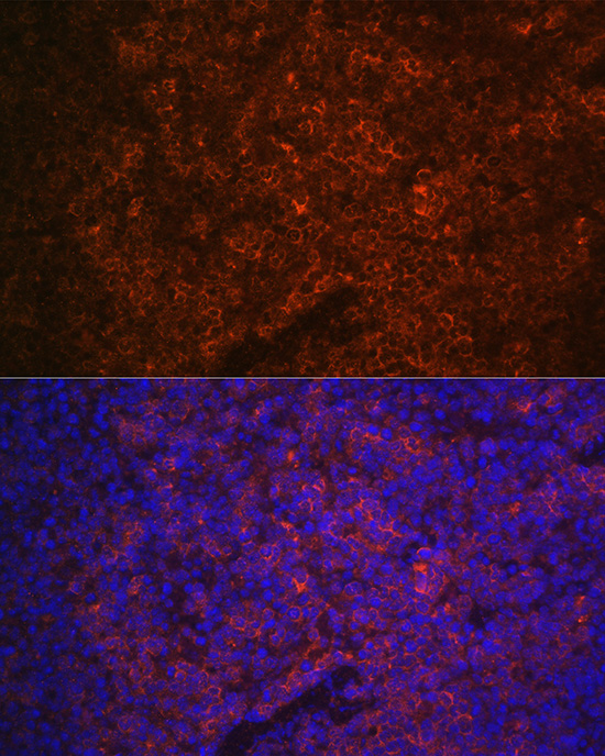 Anti-P2RX5 Antibody (CAB11710)