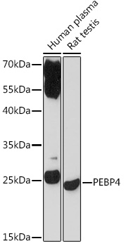 Anti-PEBP4 Antibody (CAB17961)