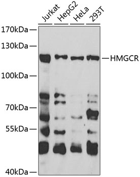 Anti-HMGCR Antibody (CAB13314)