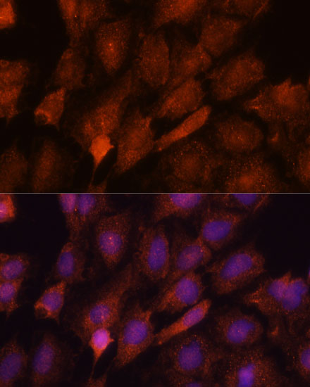 Anti-SMYD3 Antibody (CAB14516)