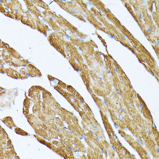 Anti-TPM2 Antibody (CAB3096)