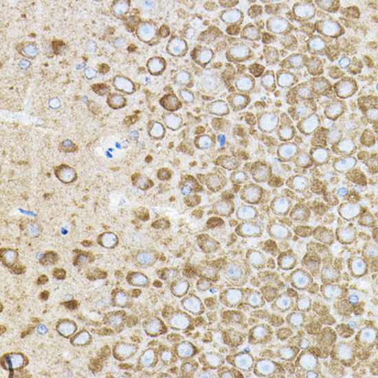 Anti-ROCK2 Antibody (CAB5698)