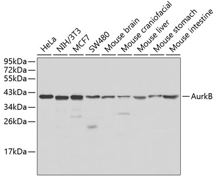 Anti-AurkB Antibody