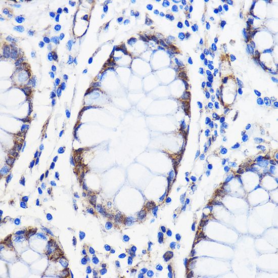 Anti-ANT1/ANT2/ANT3/ANT4 Antibody (CAB15988)