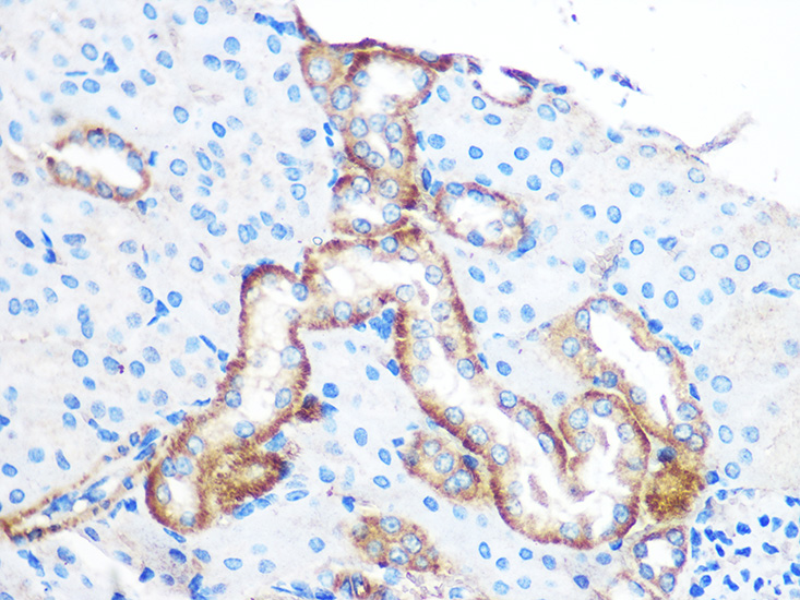 Anti-YTHDF2 Antibody (CAB15616)