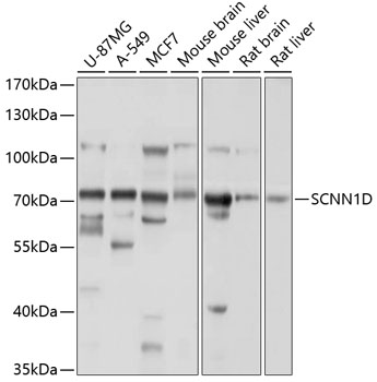 Anti-SCNN1D Antibody (CAB10242)