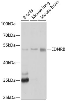 Anti-EDNRB Antibody (CAB2908)