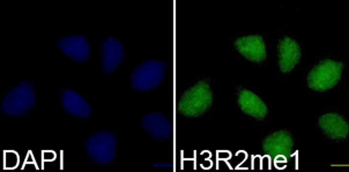 Anti-MonoMethyl-Histone H3-R2 Antibody (CAB3154)