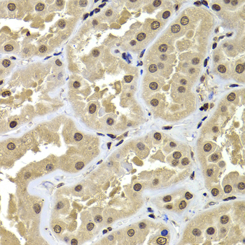 Anti-ACTL6B Antibody (CAB7108)