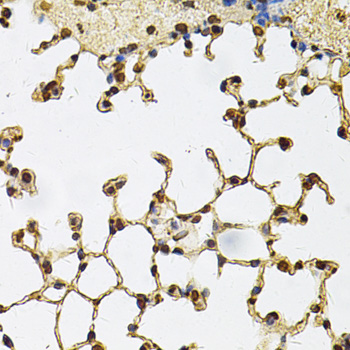 Anti-IFI16 Antibody (CAB14002)