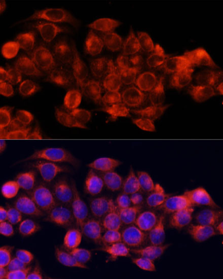 Anti-ATG5 Antibody (CAB0203)