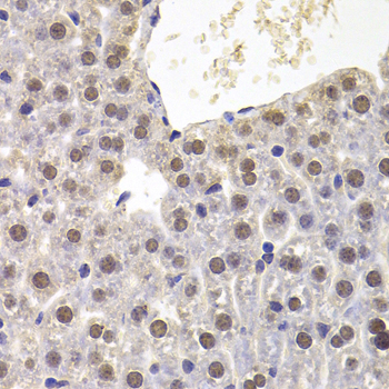 Anti-PRDM5 Antibody (CAB7361)