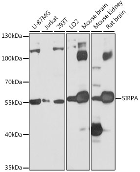 Anti-SIRPA Polyclonal Antibody (CAB9001)