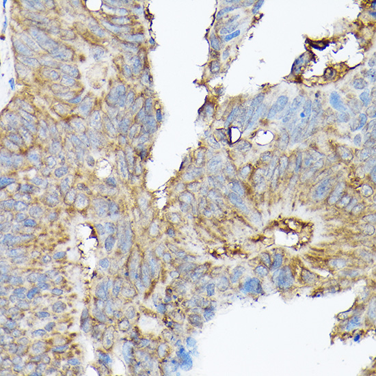 Anti-SLC8A1 Antibody (CAB5583)