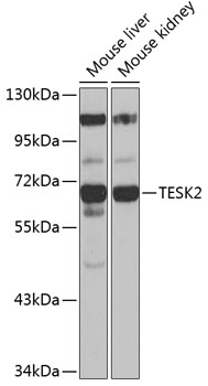 Anti-TESK2 Antibody (CAB13395)