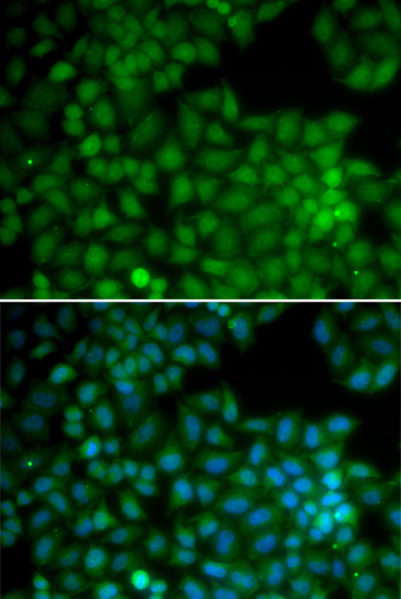 Anti-CDK7 Antibody (CAB12941)