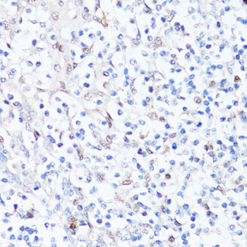 Anti-SQSTM1 / p62 Antibody (CAB11250)