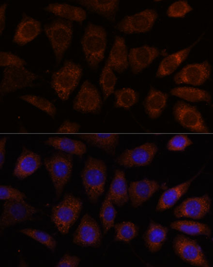 Anti-SEC24D Antibody (CAB16091)