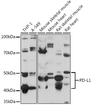 Anti-PD-L1 Antibody (CAB1645)