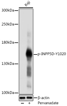 Anti-Phospho-INPP5D-Y1020 pAb (CABP0778)