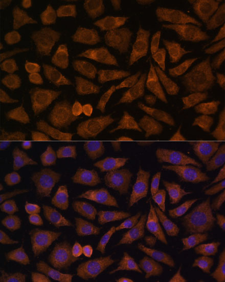 Anti-RABIF Antibody (CAB15090)