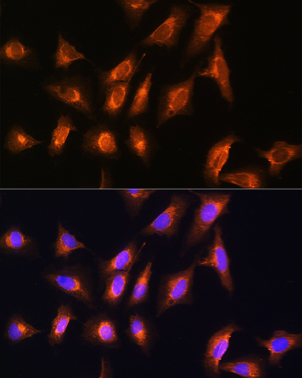 Anti-MOBP Antibody (CAB17355)