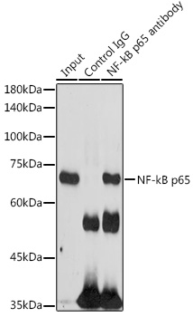 Anti-NF-kB p65 Antibody (CAB11204)