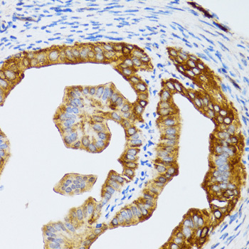 Anti-CHAF1B Antibody (CAB6259)