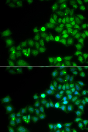 Anti-POLK Antibody (CAB6122)