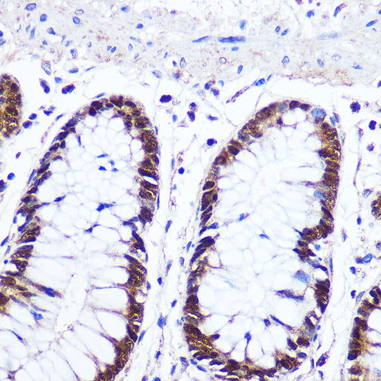 Anti-IRF1 Antibody (CAB7692)